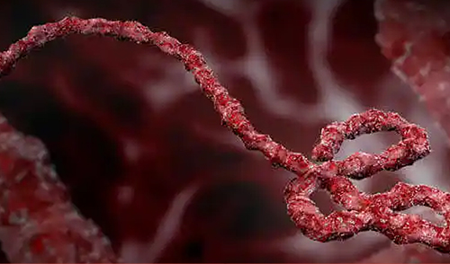 刚果金新一轮埃博拉疫情爆发！ 中科苏净推出埃博拉核酸、免疫检测一体化解决方案